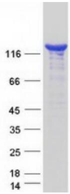 Coomassie blue staining of purified PLCG2 protein.